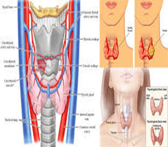 Thyroid Disorders